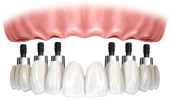 Dr. Akira Koza - Foto 1